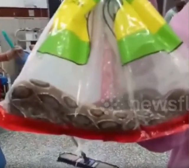 Bị rắn cắn, người đàn ông có hành động khiến bác sĩ sốc nặng - Ảnh 1.