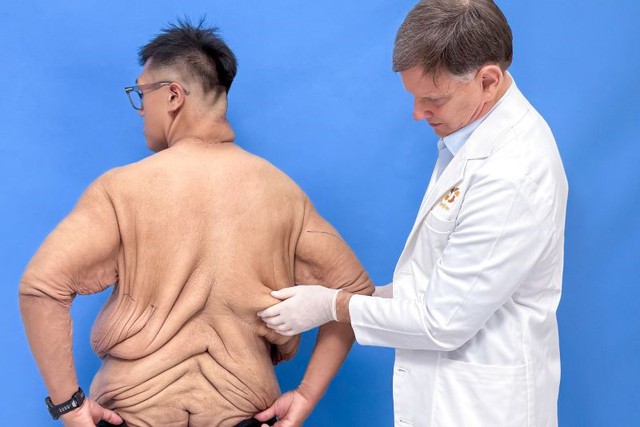 Trọng Nhân và kỳ tích giảm hơn 100kg- Ảnh 4. Trọng Nhân và kỳ tích giảm hơn 100kg- Ảnh 4.