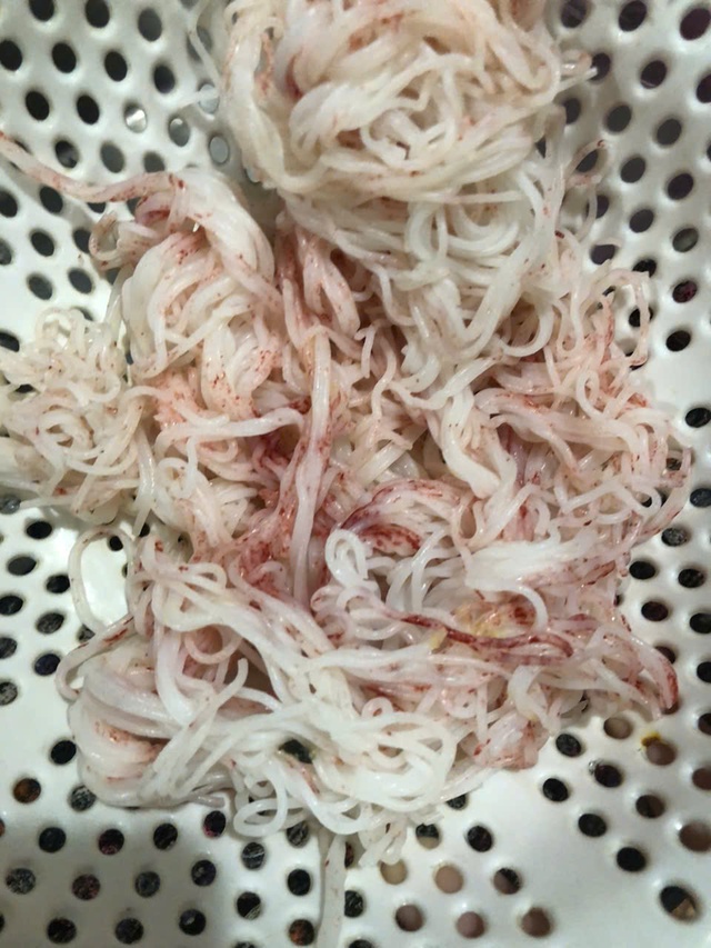 Bún đổi màu bất thường, Ban Quản lý An toàn thực phẩm Tp.Đà Nẵng đề nghị xác minh khẩn- Ảnh 2. Bún đổi màu bất thường, Ban Quản lý An toàn thực phẩm Tp.Đà Nẵng đề nghị xác minh khẩn- Ảnh 2.