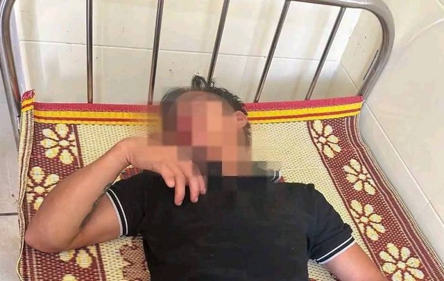 Điều tra vụ một người đàn ông đang bồng cháu bé thì bị đánh gục tại quán karaoke- Ảnh 2.