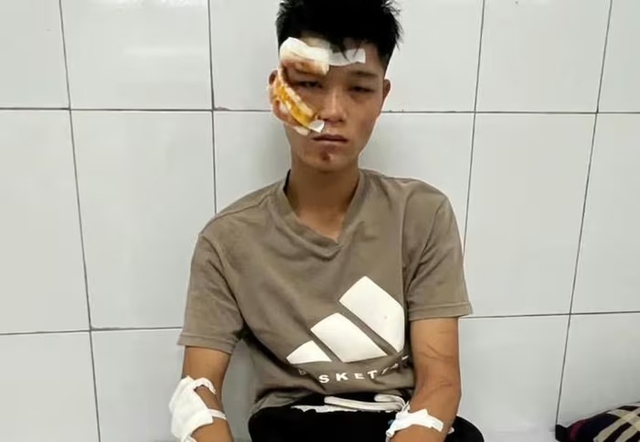 Lời khai của quái xế "thông chốt", lao xe vào cảnh sát cơ động- Ảnh 1. Lời khai của quái xế "thông chốt", lao xe vào cảnh sát cơ động- Ảnh 1.