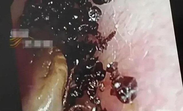 Bé gái 2 tuổi đi khám vì đau tai, bác sĩ phát hiện "bí mật đáng sợ"- Ảnh 1. Bé gái 2 tuổi đi khám vì đau tai, bác sĩ phát hiện "bí mật đáng sợ"- Ảnh 1.