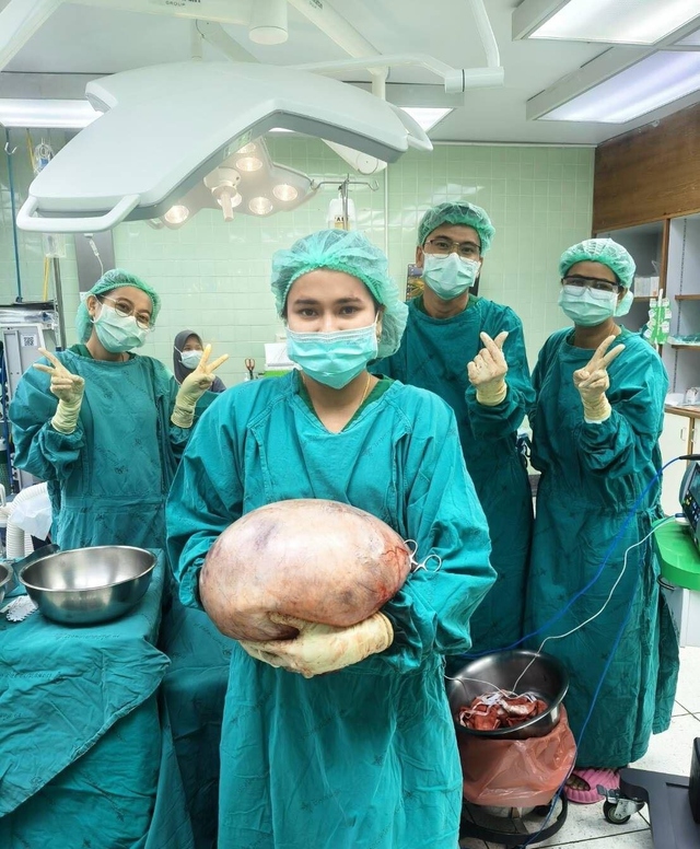 Đau bụng đi khám, các bác sĩ sốc nặng khi lấy ra thứ - Ảnh 1.