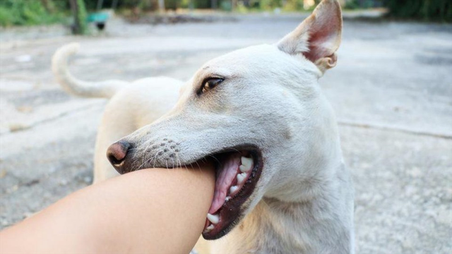 Bé gái 11 tuổi không còn cơ hội sống sau vài ngày chó nuôi chết, bác sĩ chỉ cách phòng tránh - Ảnh 1.