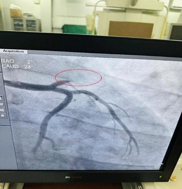 Cứu sống bệnh nhân ngừng tuần hoàn hô hấp dịp Quốc khánh- Ảnh 2. Cứu sống bệnh nhân ngừng tuần hoàn hô hấp dịp Quốc khánh- Ảnh 2.