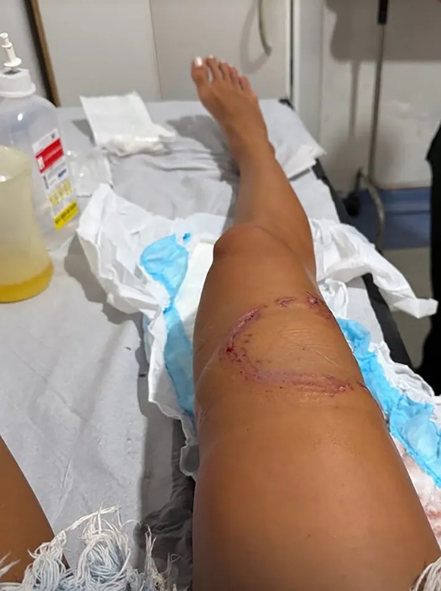 Đang lặn biển, người phụ nữ bị c&aacute; mập tấn c&ocirc;ng v&agrave; c&aacute;i kết - Ảnh 2.