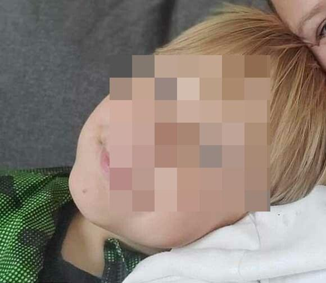 B&eacute; 11 tuổi tử vong v&igrave; bố mẹ cho uống nước theo c&aacute;ch "lạ đời" - Ảnh 1.