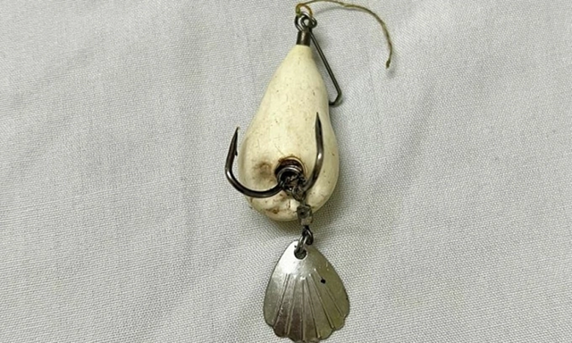 B&eacute; trai 12 tuổi đau mắt dữ dội, b&aacute;c sĩ gắp ra thứ "đ&aacute;ng sợ" b&ecirc;n trong - Ảnh 2.