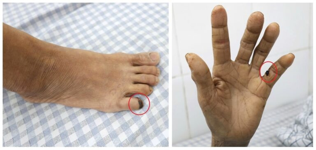 Người phụ nữ 60 tuổi "cứng h&agrave;m" v&igrave; bị g&agrave; đ&aacute; - Ảnh 1.