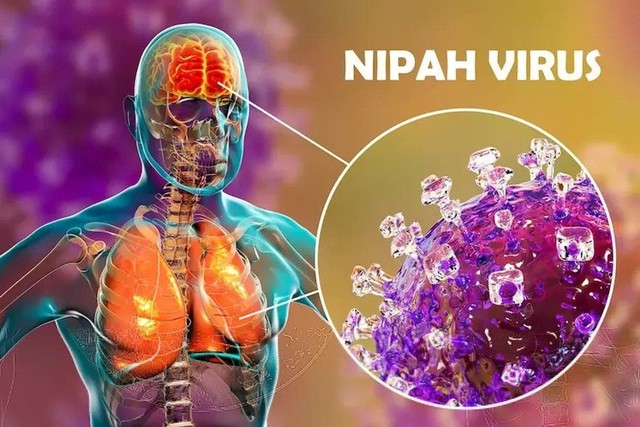 Gi&aacute;m s&aacute;t v&agrave; ph&ograve;ng bệnh do virus Nipah ở người thế n&agrave;o?- Ảnh 2.