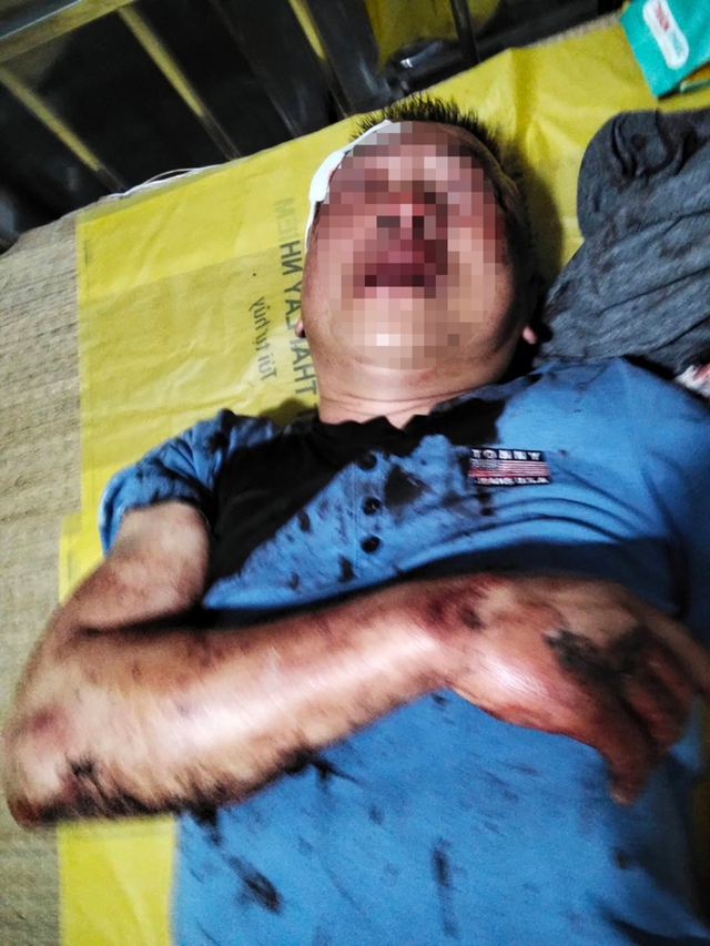 X&aacute;c minh nh&oacute;m đối tượng h&agrave;nh hung c&ocirc;ng an vi&ecirc;n khi bị nhắc nhở việc nẹt p&ocirc; - Ảnh 2.