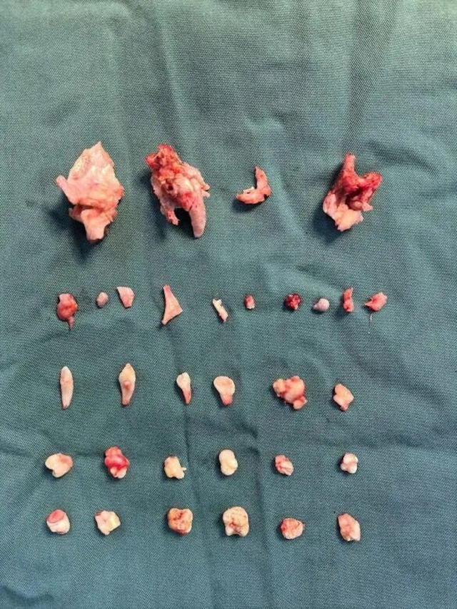 C&ocirc; g&aacute;i đau bụng dữ dội, b&aacute;c sĩ ph&aacute;t hiện ra b&iacute; mật b&ecirc;n trong - Ảnh 1.