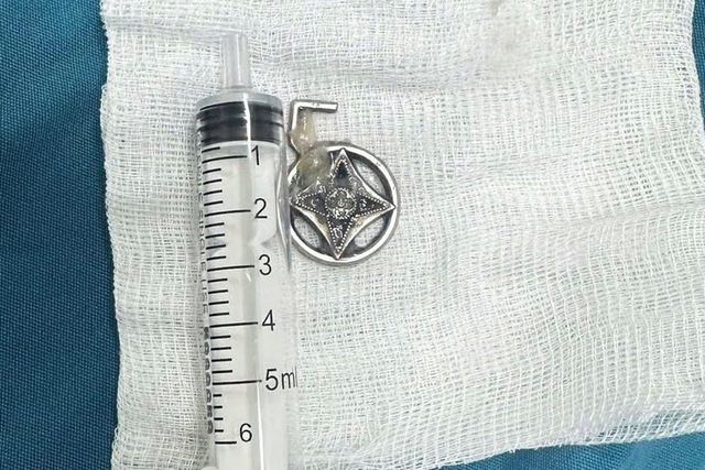 Con đang chơi đột nhiên khóc ngặt nghẽo, mẹ hoảng hồn phát hiện "bí mật" bất thường - Ảnh 1.