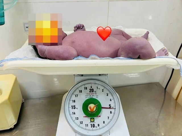 Hiếm gặp b&eacute; trai ch&agrave;o đời nặng 5,4 kg - Ảnh 1.