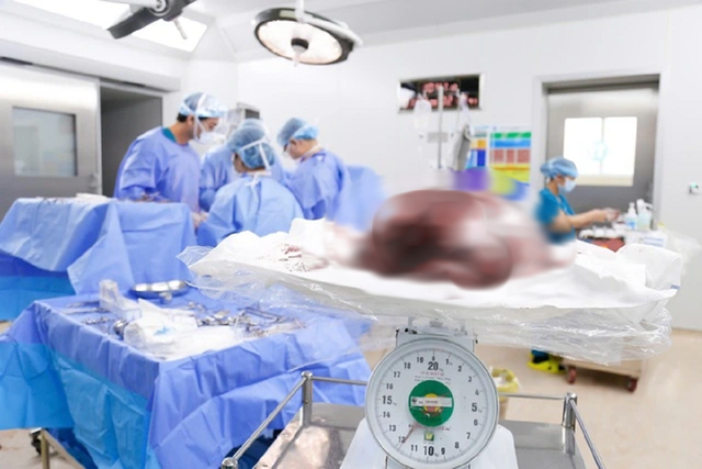 Ph&aacute;t hiện "thứ đ&aacute;ng sợ" gần 12kg trong tử cung của c&ocirc; g&aacute;i 25 tuổi - Ảnh 1.
