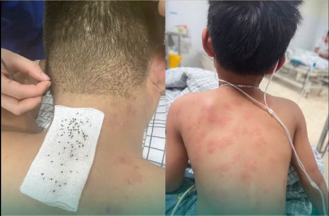 Hai bố ngất xỉu, đến viện b&aacute;c sĩ gắp ra thứ "đ&aacute;ng sợ" b&ecirc;n trong - Ảnh 1.