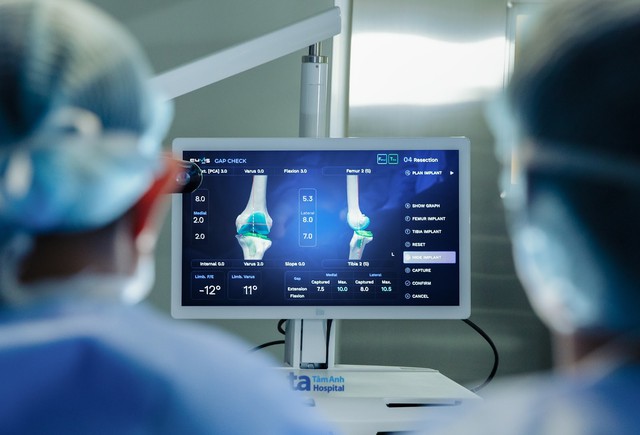 Siêu hot - Robot AI đầu tiên tại Việt Nam phẫu thuật thay khớp chuẩn xác vượt trội - Ảnh 3.