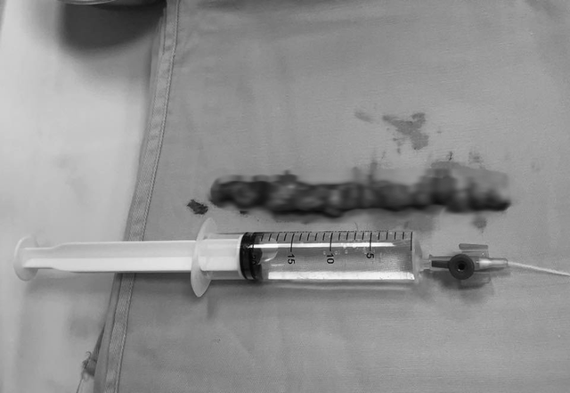 Đau lưng k&eacute;o d&agrave;i tưởng xương khớp,  người phụ nữ t&aacute; hỏa khi biết m&igrave;nh mắc bệnh nguy hiểm - Ảnh 1.