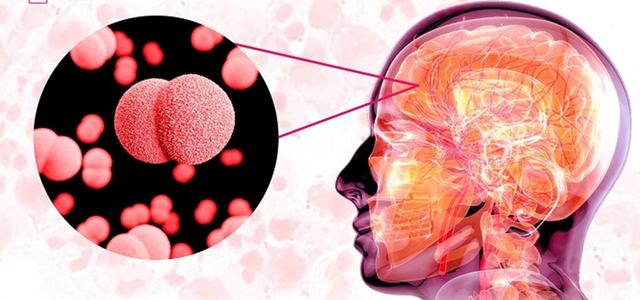 Bệnh nguy hiểm đ&atilde; c&oacute; 4 ca kh&ocirc;ng qua khỏi, Viện Pasteur Tp.HCM cảnh b&aacute;o - Ảnh 1.