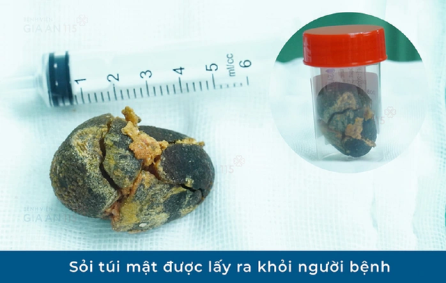 Đi kh&aacute;m sức khỏe định kỳ, người phụ nữ trẻ "sốc" khi ph&aacute;t hiện điều bất ngờ - Ảnh 1.