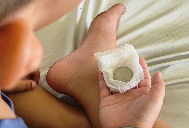 B&eacute; trai 7 tuổi li&ecirc;n tục n&ocirc;n &oacute;i, b&aacute;c sĩ gắp ra thứ "đ&aacute;ng sợ" b&ecirc;n trong - Ảnh 2.