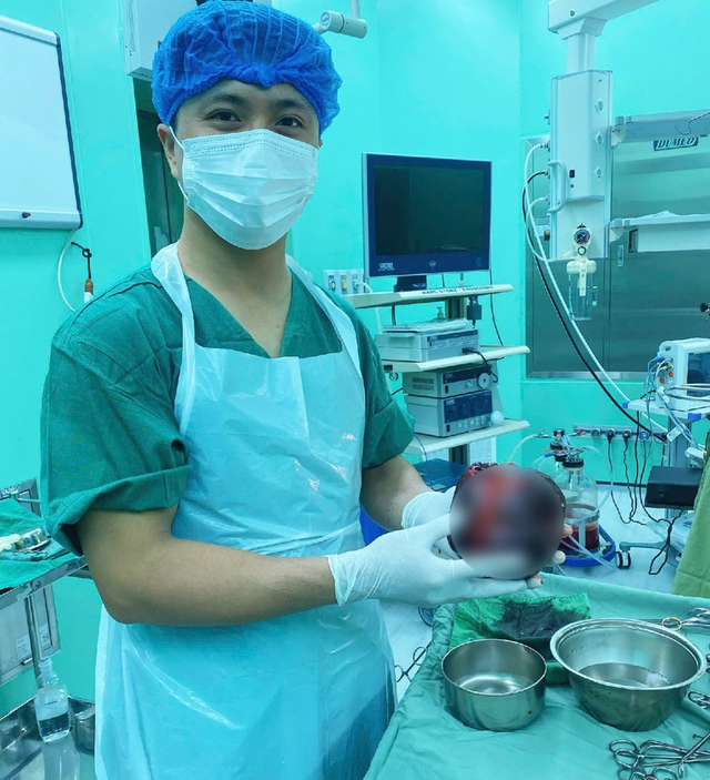 Đau bụng tưởng nhẹ, người đàn ông "sốc nặng" khi phát hiện thứ "đáng sợ" to bằng quả dưa lưới- Ảnh 1. Đau bụng tưởng nhẹ, người đàn ông "sốc nặng" khi phát hiện thứ "đáng sợ" to bằng quả dưa lưới- Ảnh 1.