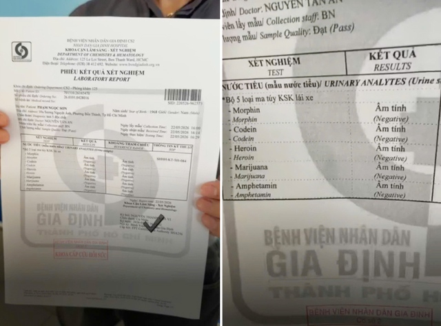 "Ông hoàng nhạc sến" đi xét nghiệm chất cấm, tuyên bố bỏ nghề nếu dương tính - Ảnh 5.