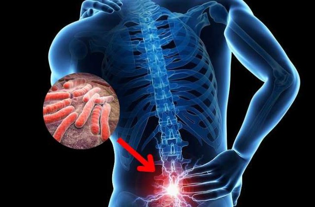 Người đàn ông 53 tuổi đột ngột bị liệt vào buổi sáng, bác sĩ chỉ rõ "sai lầm chí mạng"- Ảnh 1. Người đàn ông 53 tuổi đột ngột bị liệt vào buổi sáng, bác sĩ chỉ rõ "sai lầm chí mạng"- Ảnh 1.