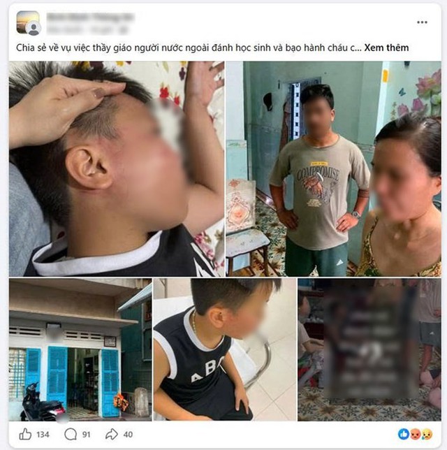 Vụ nam sinh lớp 4 bị giáo viên đánh bầm mặt: Bất ngờ phát hiện lớp dạy tiếng Anh “chui” - Ảnh 2.
