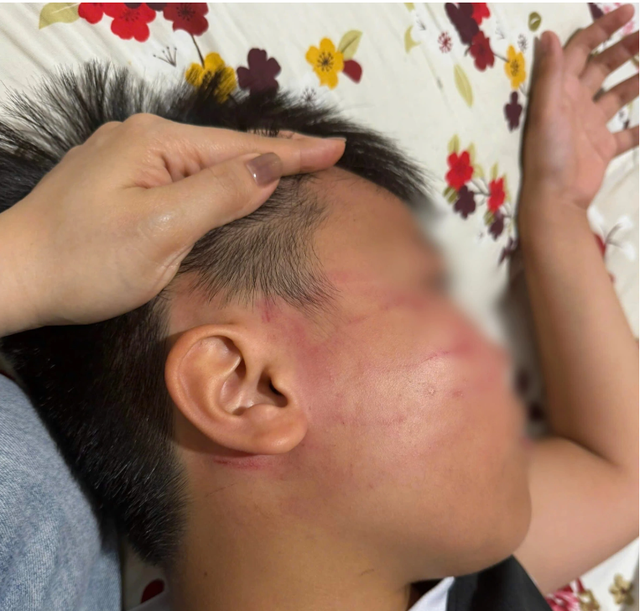 Vụ nam sinh lớp 4 bị giáo viên đánh bầm mặt: Bất ngờ phát hiện lớp dạy tiếng Anh “chui” - Ảnh 1.