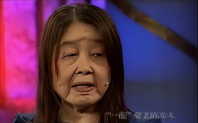 C&ocirc; g&aacute;i 28 tuổi bỗng gi&agrave; đi nhanh ch&oacute;ng, họ h&agrave;ng tưởng "b&agrave; l&atilde;o 80"- Ảnh 4.