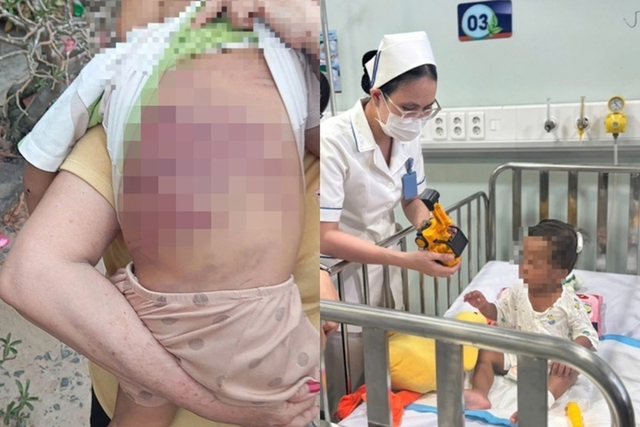 X&oacute;t xa nhiều trẻ bị bạo h&agrave;nh ngay trong gia đ&igrave;nh, Bộ Y tế chỉ đạo khẩn - Ảnh 1.