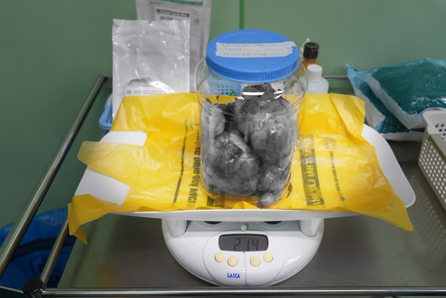 Bóc tách thành công 9 khối u xơ tử cung nặng 2,1kg và đón bé trai chào đời - Ảnh 2.