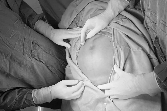 Bụng to nhanh bất thường, người phụ nữ "sốc" khi biết bí mật trong cơ thể - Ảnh 1.