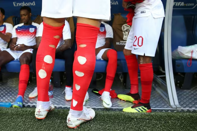 Vì sao nhiều cầu thủ World Cup lại mang tất "thủng lỗ chỗ"? - Ảnh 2.