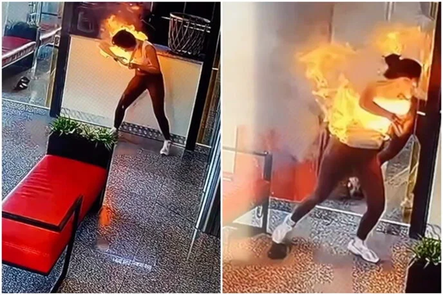 Đang dùng điện thoại, cô gái "sốc" vì lửa bao trùm mặt - Ảnh 1.