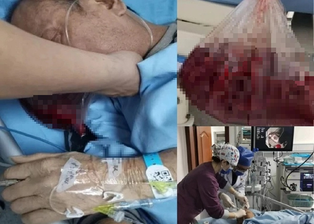 Người đ&agrave;n &ocirc;ng su&yacute;t tử vong v&igrave; n&ocirc;n ra hơn 2 l&iacute;t m&aacute;u, b&aacute;c sĩ cảnh b&aacute;o 4 th&oacute;i quen ăn "cực độc" - Ảnh 1.