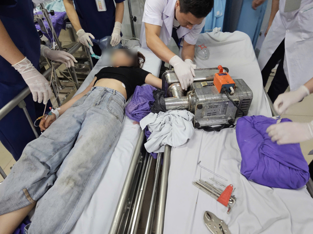 Cô gái 19 tuổi bị mất bàn tay do tai nạn trong lúc vận hành máy xay - Ảnh 1.