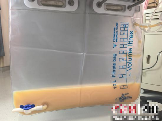 Người phụ nữ 45 tuổi "máu trắng đục như sữa" vì uống thứ quen thuộc nhiều người mê - Ảnh 1.