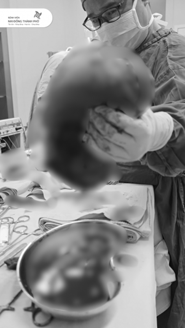 Bé 14 tuổi có vùng mông to bất thường, sự thật phía sau khiến gia đình "sốc ngang" - Ảnh 1.