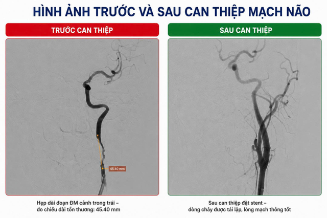 Nam thanh niên 33 tuổi bất ngờ co giật sau khi tắm - Ảnh 2.