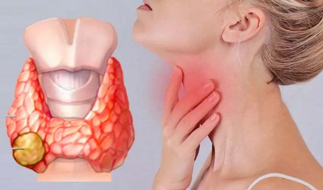 C&oacute; những biểu hiện n&agrave;y, đừng chủ quan v&igrave; c&oacute; thể l&agrave; dấu hiệu ung thư - Ảnh 1.