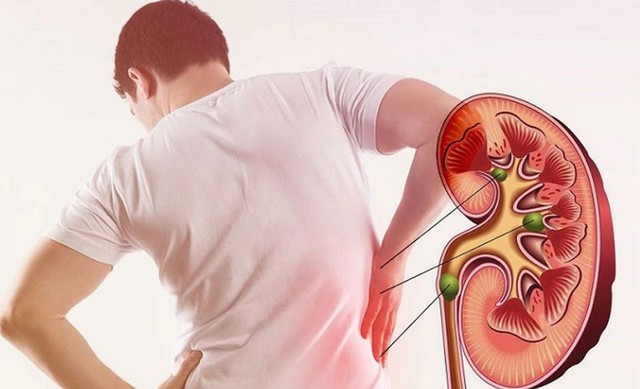 Người đ&agrave;n &ocirc;ng 39 tuổi suy thận v&igrave; "sai lầm ch&iacute; mạng" khi tắm - Ảnh 2.