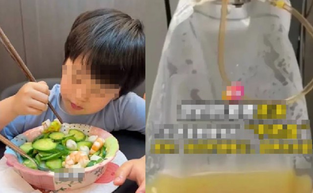 B&eacute; trai 5 tuổi m&aacute;u "trắng đục như sữa" v&igrave; thường xuy&ecirc;n ăn m&oacute;n canh quen thuộc - Ảnh 1.