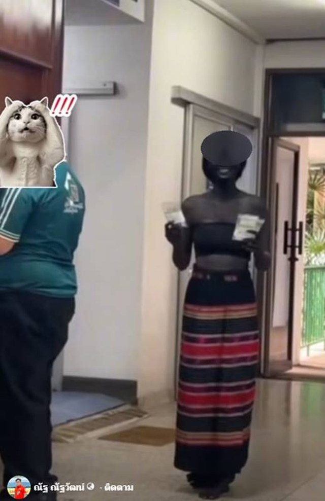 Đội cứu hộ "to&aacute;t mồ h&ocirc;i" khi thấy bệnh nh&acirc;n c&oacute; gương mặt kỳ lạ - Ảnh 3.