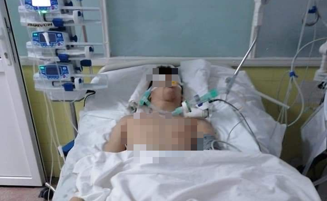 Người đàn ông 50 tuổi tử vong vì thói quen nhiều người tưởng tốt, bác sĩ cảnh báo nguy cơ "cực độc" ít ai ngờ - Ảnh 1.