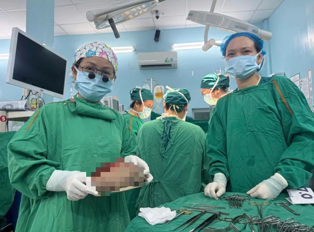 Bé 5 ngày tuổi có khối u quái nặng 1,3 kg - Ảnh 1.