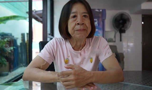 Mắc hội chứng lạ, người phụ nữ 29 tuổi trông giống cụ bà 80 tuổi - Ảnh 1.
