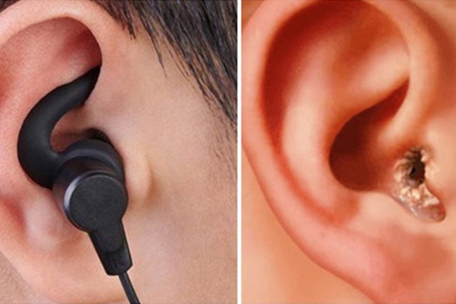 Nhiều người đeo tai nghe không đúng cách khi chạy bộ mà không biết - Ảnh 1.