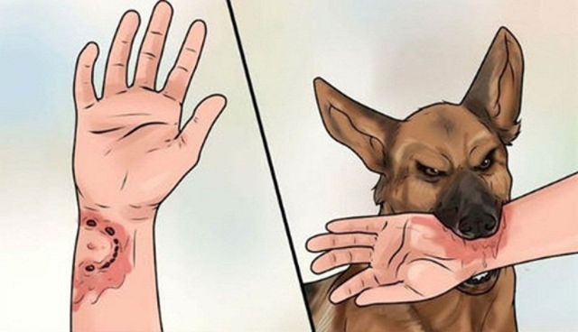Bộ Y tế: Quyết liệt phòng bệnh dại, hạn chế thấp nhất ca tử vong - Ảnh 1.